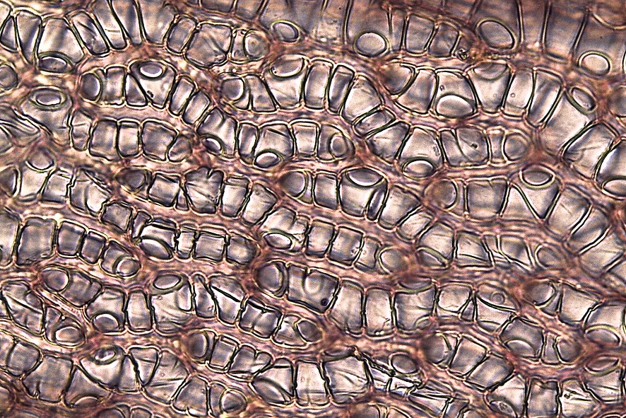 Mikroskopaufnahme eines Torfmooses © Christian Schröck